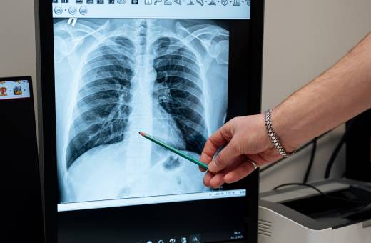 Позвоночник